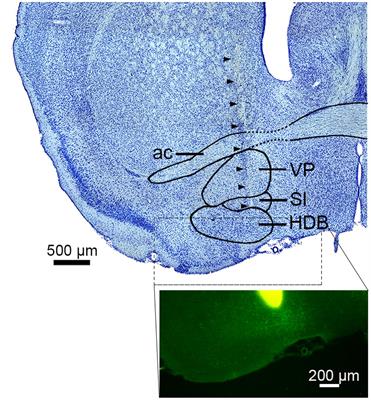 Distinct Temporal Coordination of Spontaneous Population Activity between Basal Forebrain and Auditory Cortex